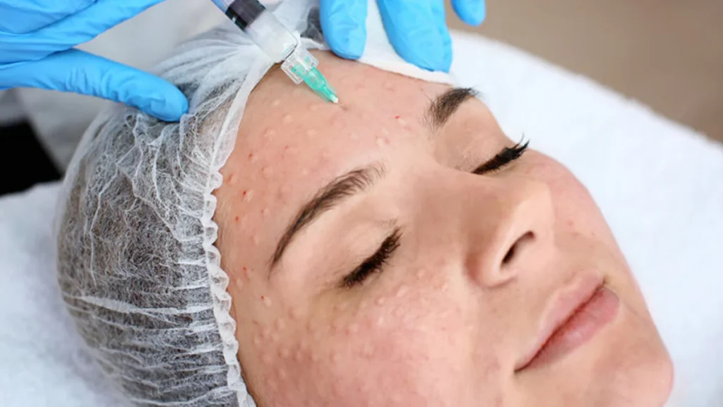 İstanbul Mezoterapi Fiyatları | WWW İstanbul