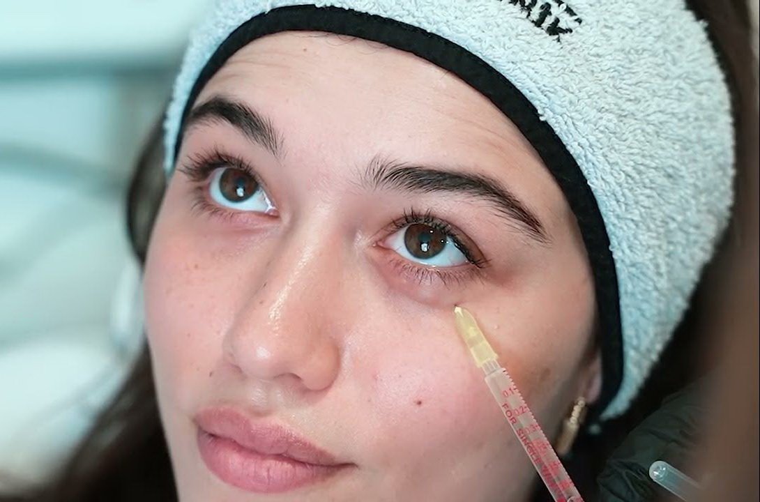 Göz Altı Mezoterapi | WWW İstanbul