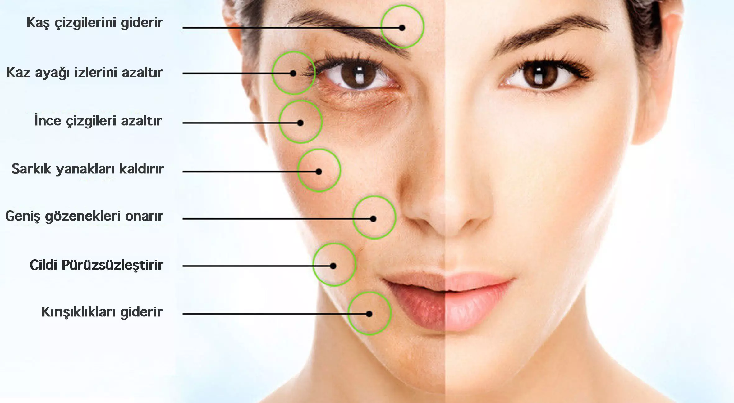 Mezoterapi Nedir Ne Yapar | WWW İstanbul