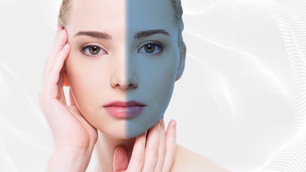 Mezoterapi Uygulaması | WWW İstanbul